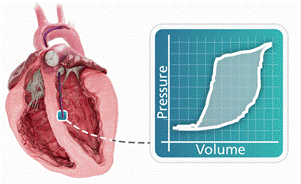 Catheter Placement GIF