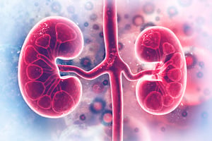 ESRD treatment model image