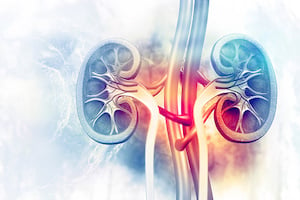 advancing american kidney health