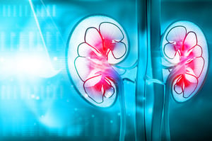 end stage renal disease stats