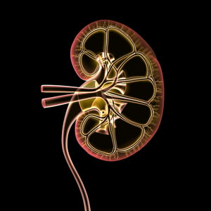 end-stage renal disease in the us