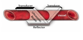 transit time ultrasound