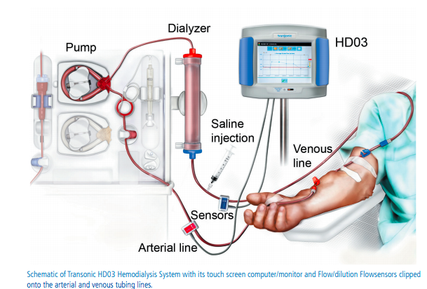 What Bioengineers Should Know About Flow Measurement for Dialysis for ...