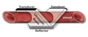 Transit Time Theory Wide  Beam