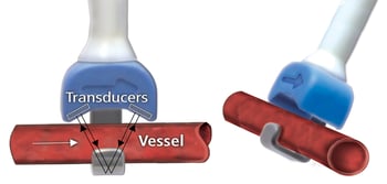 Transit Time Theory straight vessel