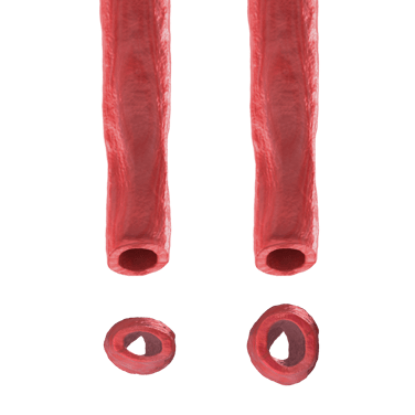 Vessel Cross Section