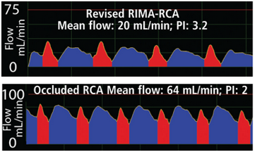 competitive-flow