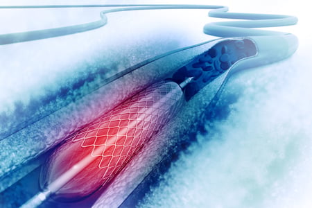 How Do Flow Measurements Help Cardiothoracic Surgeons?