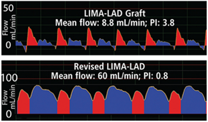 pulsality-index