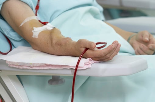 Controlling Life Threatening Bleeds (LTB) from Arteriovenous Fistulas or Grafts