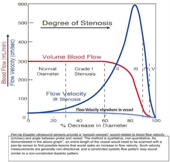 bypass-graft-patency